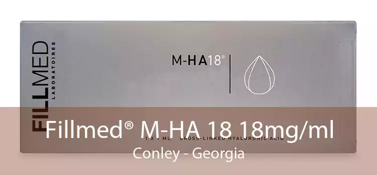 Fillmed® M-HA 18 18mg/ml Conley - Georgia
