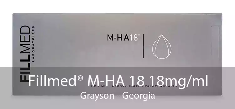 Fillmed® M-HA 18 18mg/ml Grayson - Georgia
