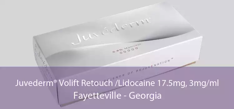 Juvederm® Volift Retouch /Lidocaine 17.5mg, 3mg/ml Fayetteville - Georgia