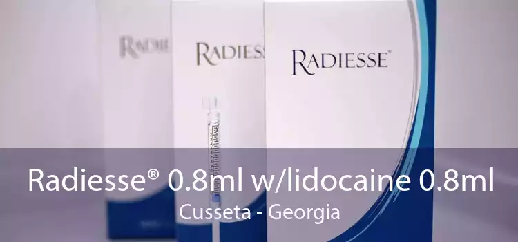 Radiesse® 0.8ml w/lidocaine 0.8ml Cusseta - Georgia