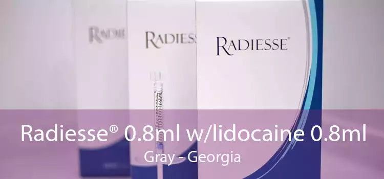 Radiesse® 0.8ml w/lidocaine 0.8ml Gray - Georgia