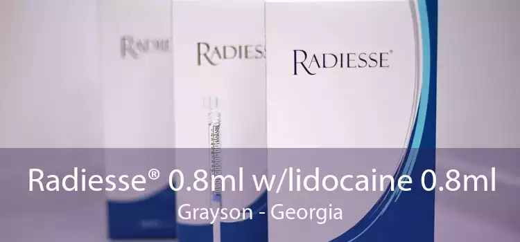 Radiesse® 0.8ml w/lidocaine 0.8ml Grayson - Georgia