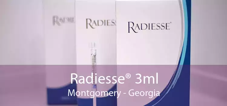 Radiesse® 3ml Montgomery - Georgia