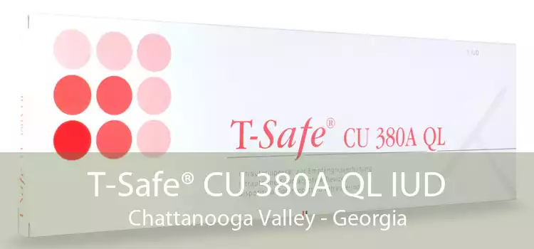 T-Safe® CU 380A QL IUD Chattanooga Valley - Georgia
